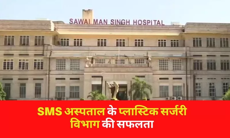 जयपुर SMS अस्पताल के प्लास्टिक सर्जरी विभाग की सफलता